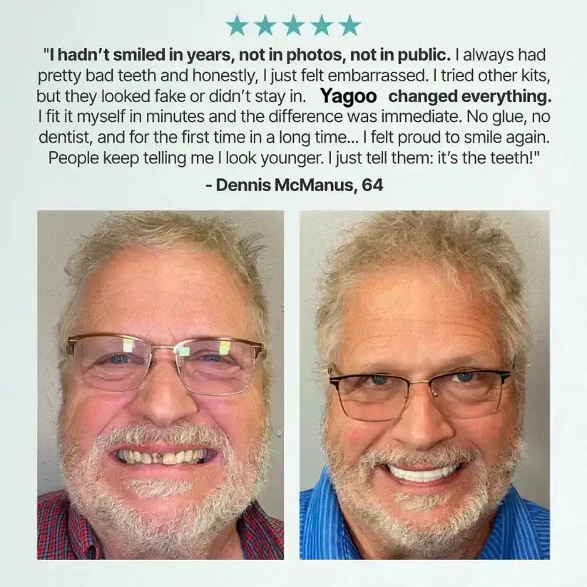 Custom-Fit Smile Support Kit — Strong Suction Feel & Natural-Looking Fit - Image 19