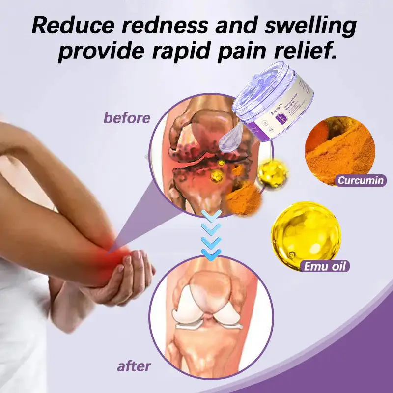 Turmeric & Emu Oil Arthritis Soothing Pain Relief Massage Gel for Stiff Joints & Aches - Image 6