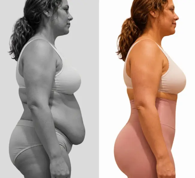 Shapewear Shorts-Confidence Starts Under Your Outfit - Image 3
