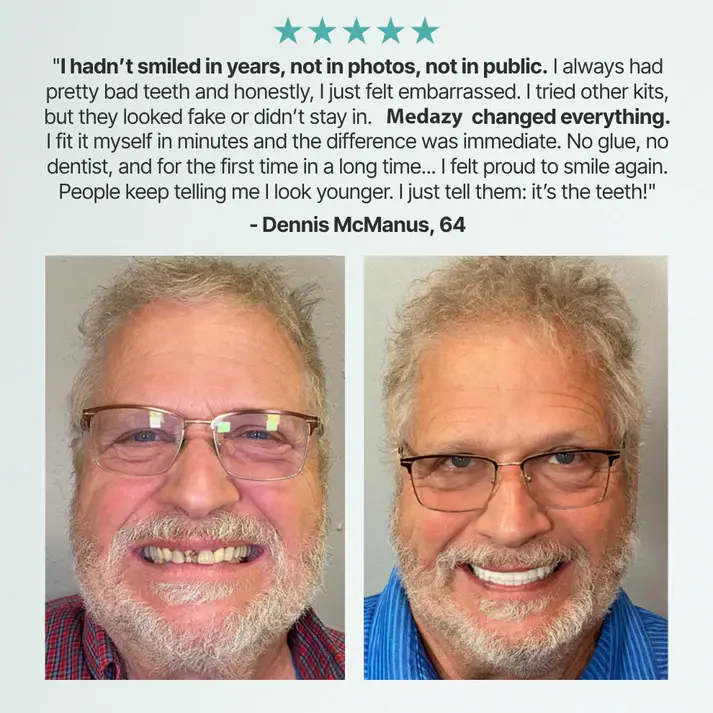 Custom-Fit Full Functional Dentures - Image 8