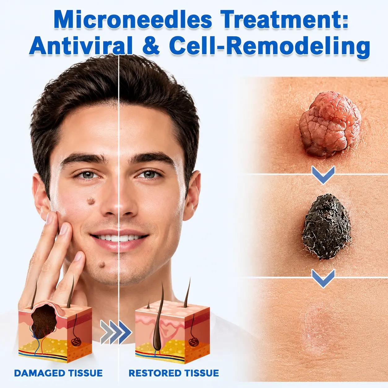 2-in-1 & Hydrocolloid Patch - Image 4
