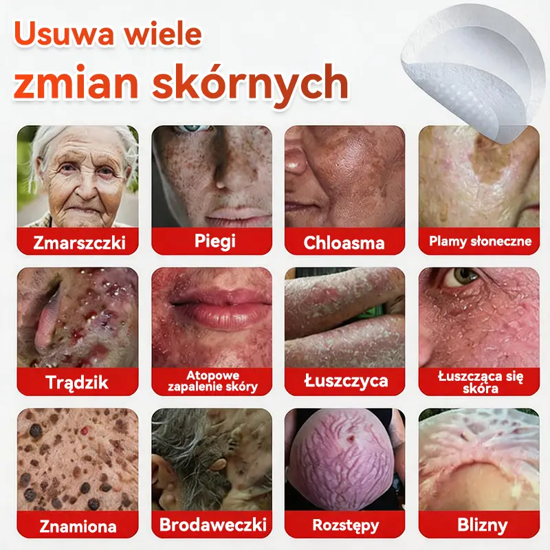 Patches for removing warts and moles using plant-based micro-needles - Image 2