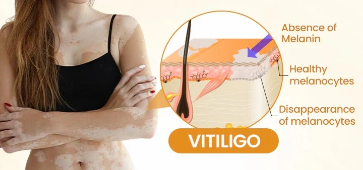 VitiCalm Bee Venom Cream - Image 10