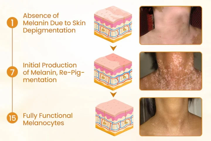 VitiCalm Bee Venom Cream - Image 6