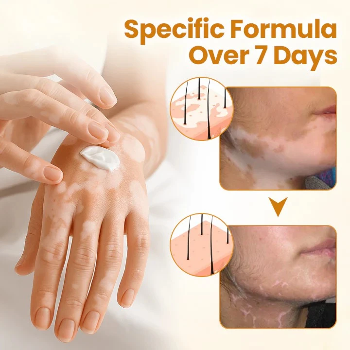 VitiCalm Bee Venom Cream - Image 7