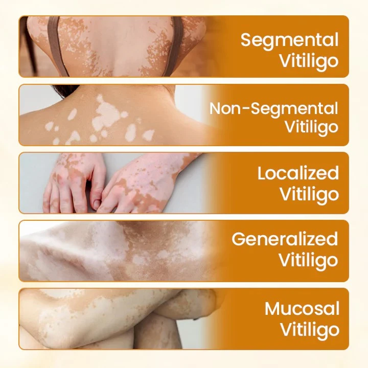 VitiCalm Bee Venom Cream - Image 9