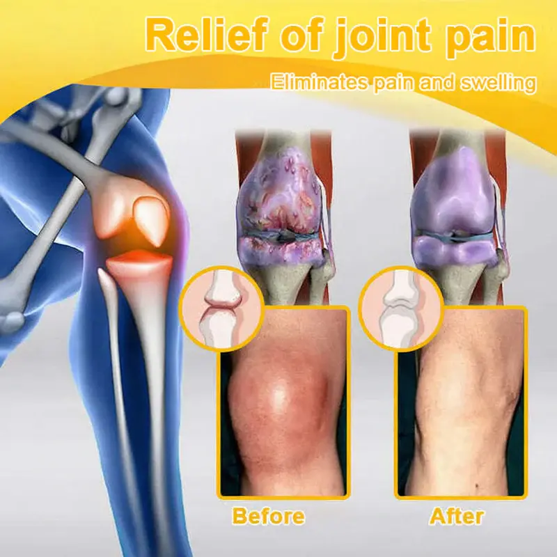 Bee Venom Pain-Relief Joint Soothing Spray - Image 14