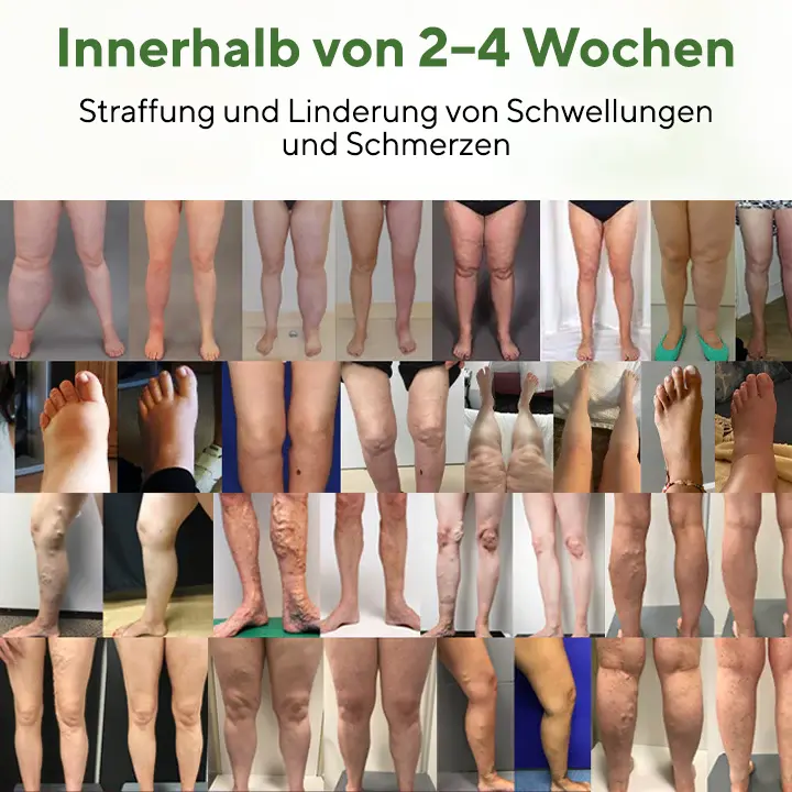 FluidEase Beintherapie-Ödemcreme - Image 2
