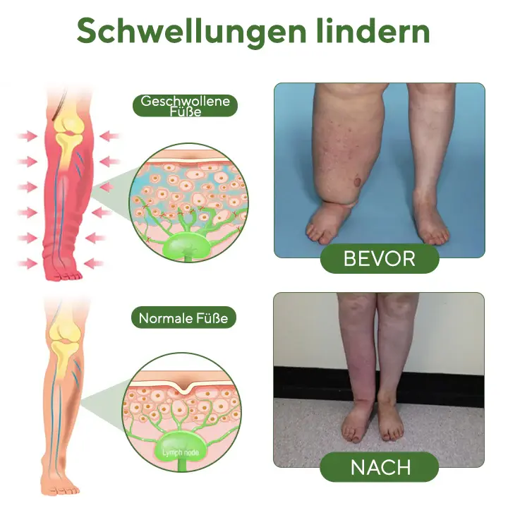 FluidEase Beintherapie-Ödemcreme - Image 4