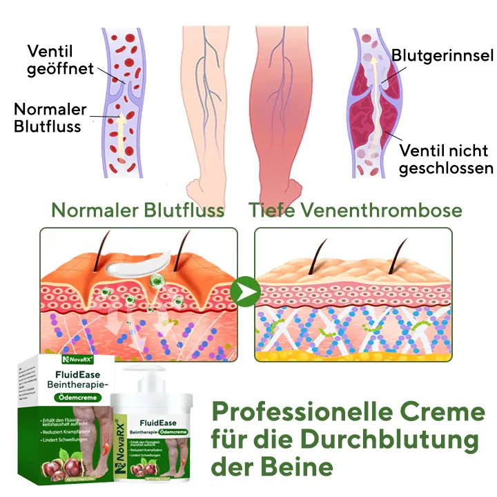FluidEase Beintherapie-Ödemcreme - Image 6