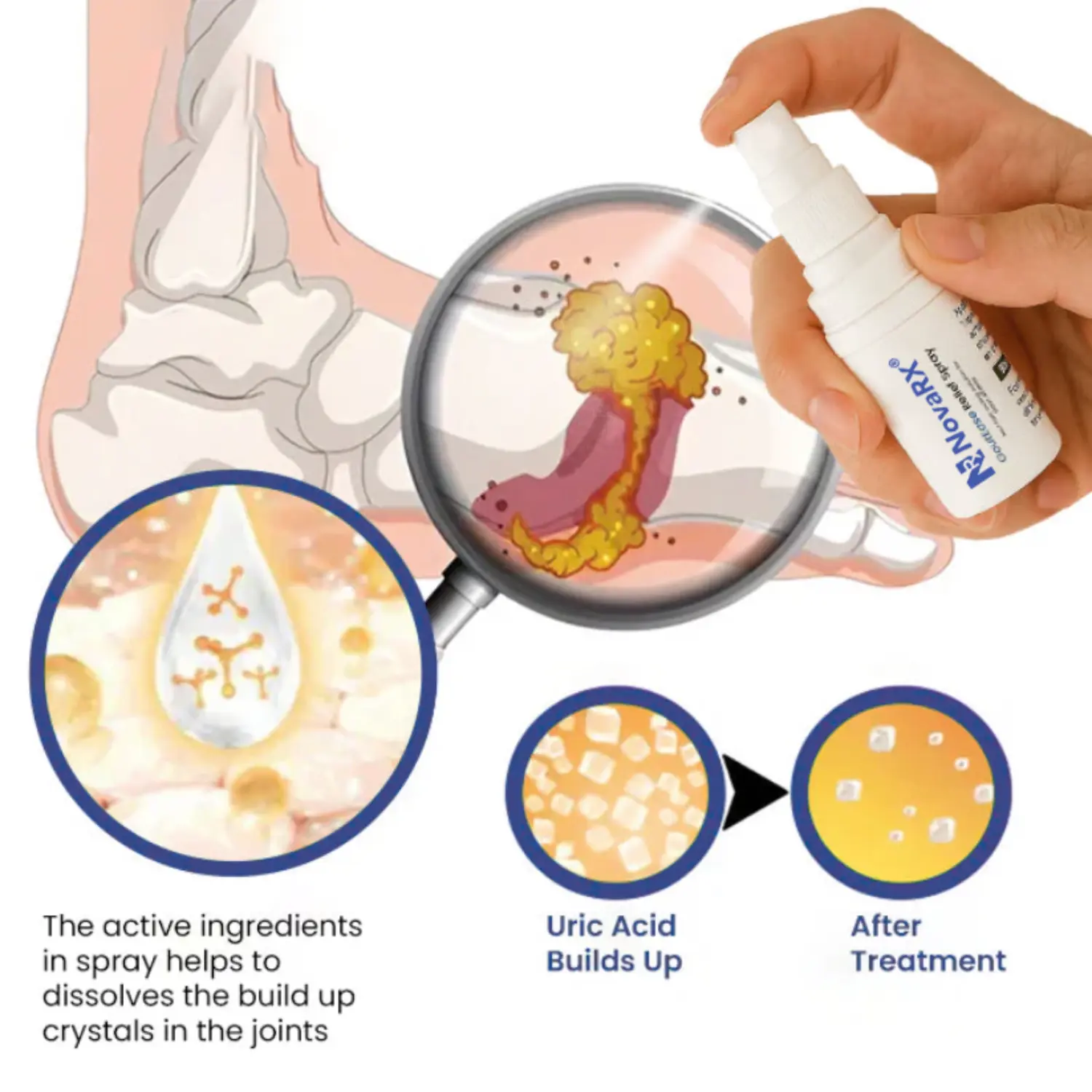 GoutEase Relief Spray - Image 5