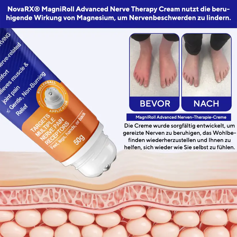MagniRoll Advanced Nerven-Therapie-creme - Image 2