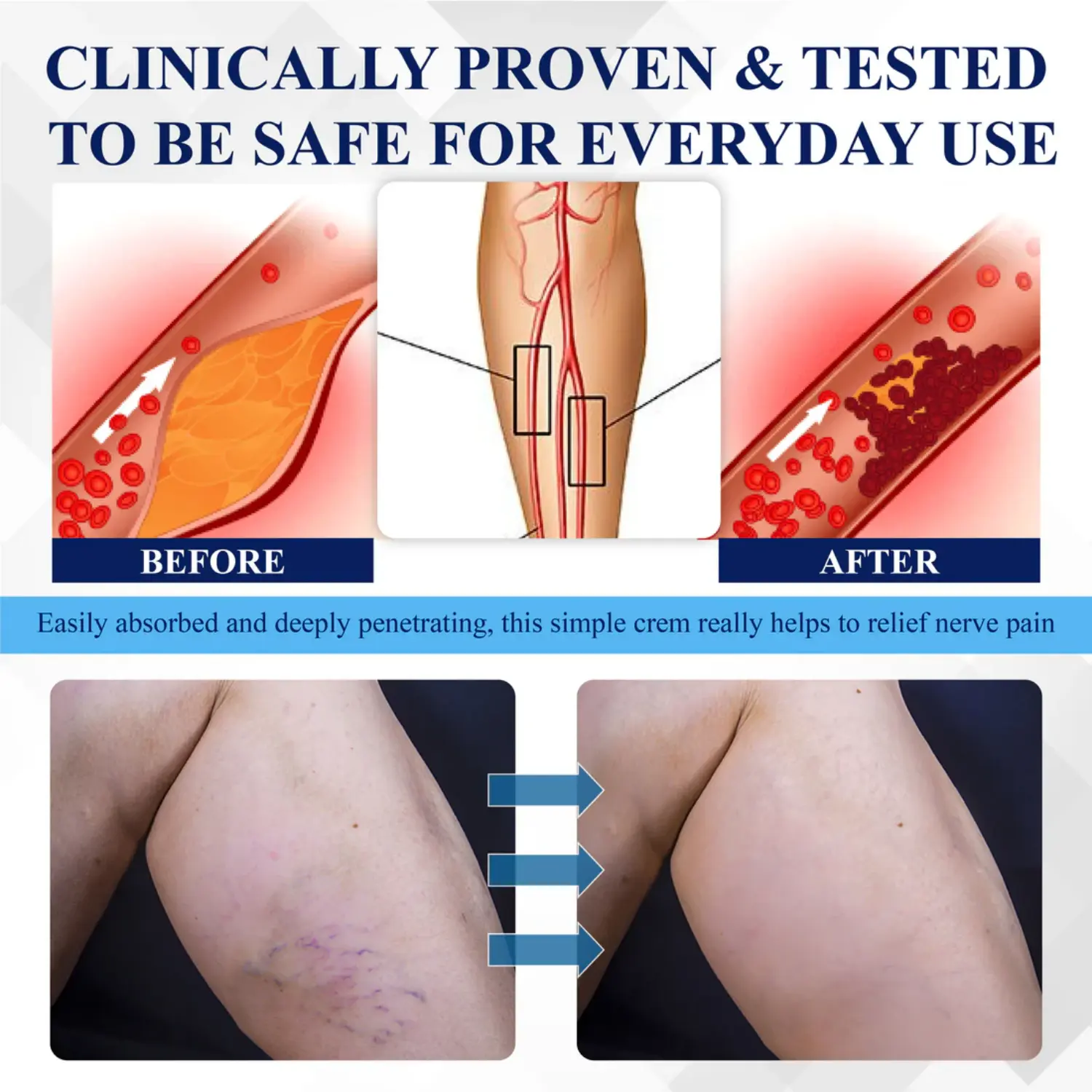 NerveRelief LC Treatment Cream - Image 3