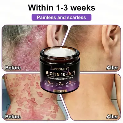 Biotin 10-in-1 Skin Restoration Cream - Image 6