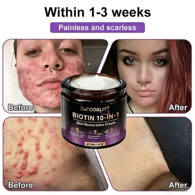 Biotin 10-in-1 Skin Restoration Cream - Image 7