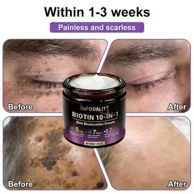 Biotin 10-in-1 Skin Restoration Cream - Image 8