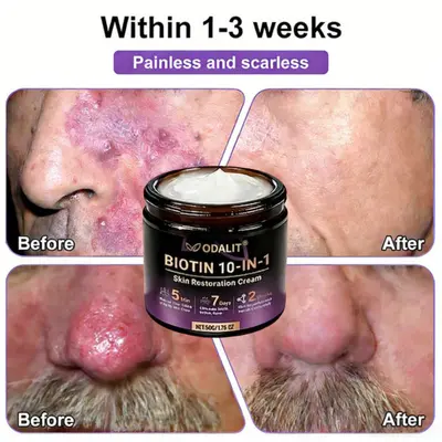 Biotin 10-in-1 Skin Restoration Cream - Image 9