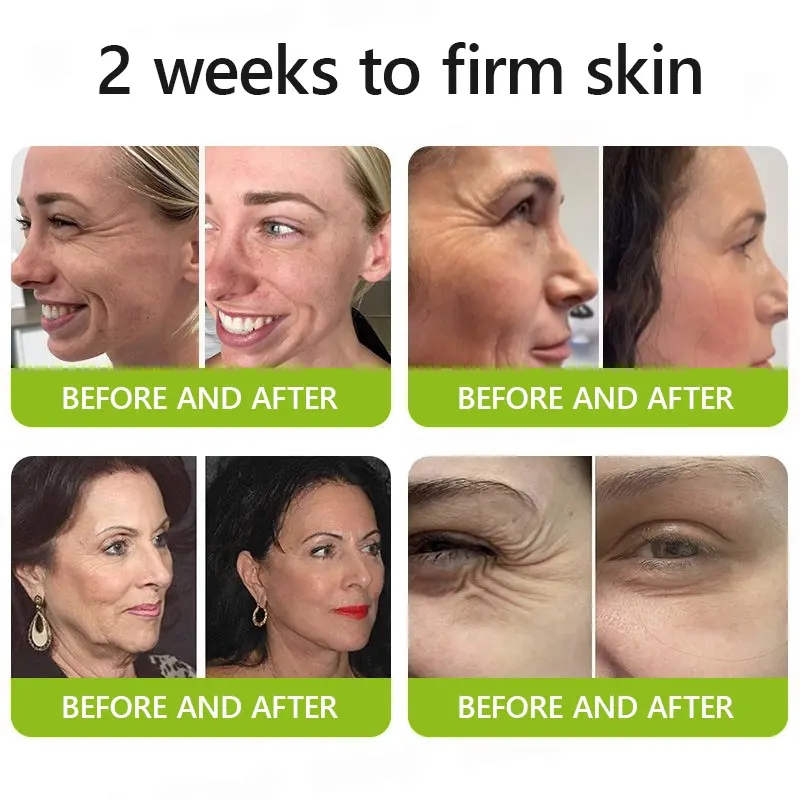 Botox Retinol Shot - Eraser for Deep Wrinkles, Sagging Jowls Puffy Eyes - Image 5