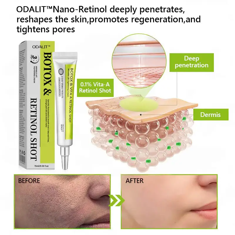 Botox Retinol Shot - Eraser for Deep Wrinkles, Sagging Jowls Puffy Eyes - Image 8