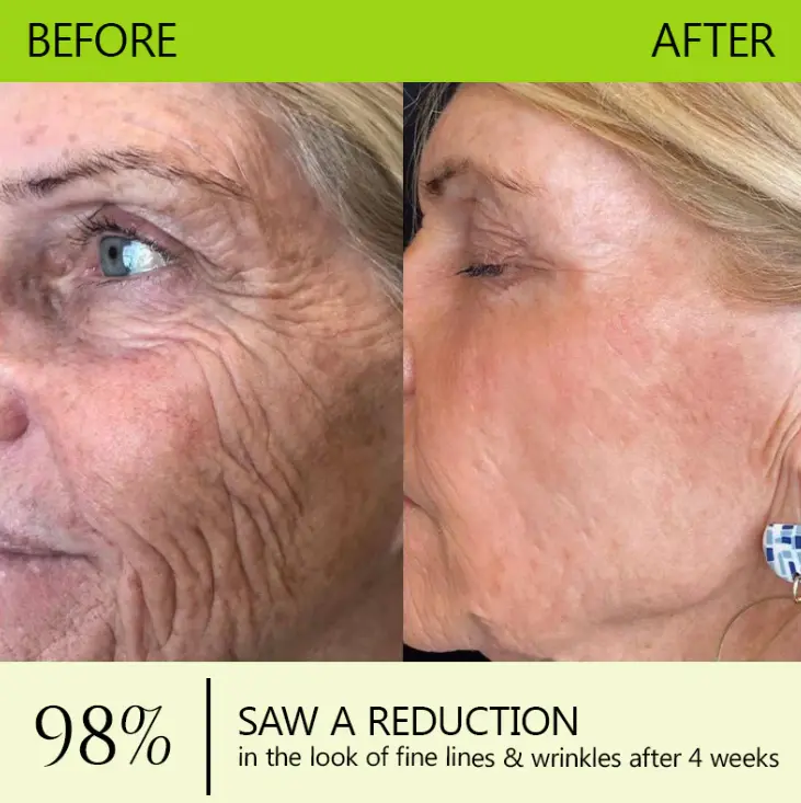Botox Retinol Shot - Image 3