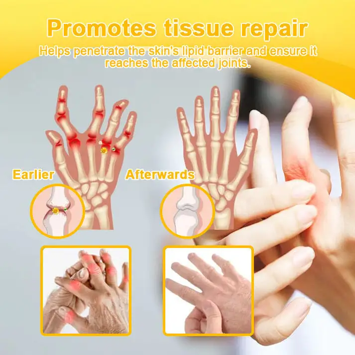 Botulinum Toxin & Bee Venom Pain-Relief Bone Healing Cream - Image 10