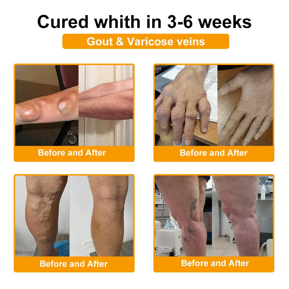Botulinum Toxin & Bee Venom Pain-Relief Bone Healing Cream - Image 15