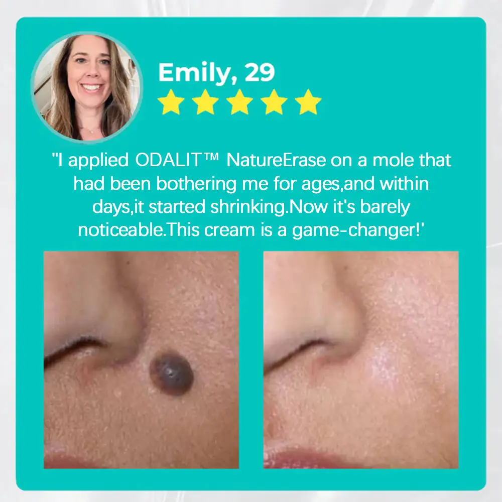 Nature Erase Instant Mole & Spot Removal Gel - Image 6