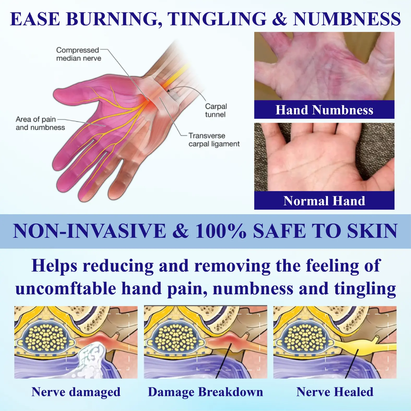 NumbAway CoolEase Neuropathy Spray - Image 5