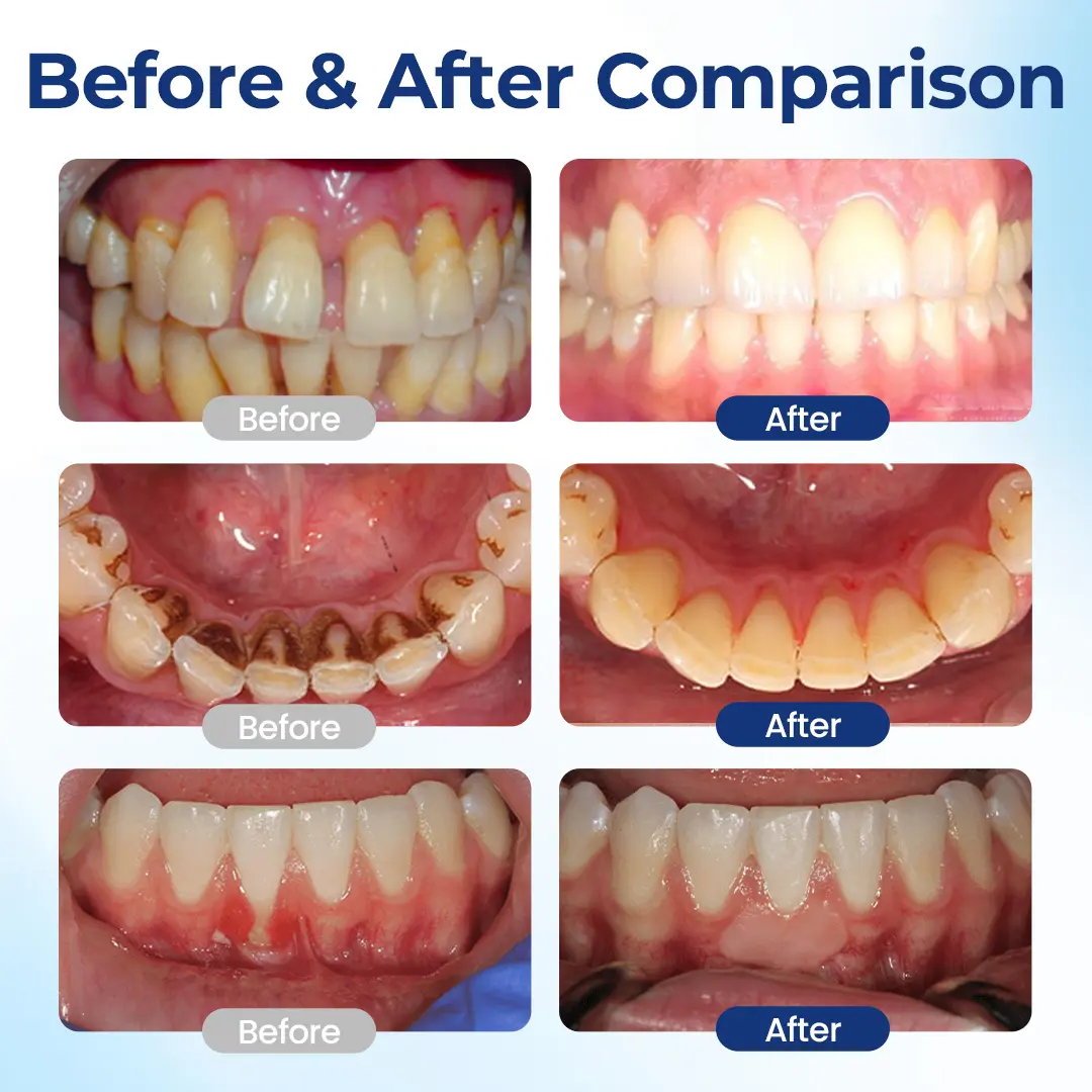 Oral Repair – Fix Gums & Stop Sensitivity Fast - Image 3