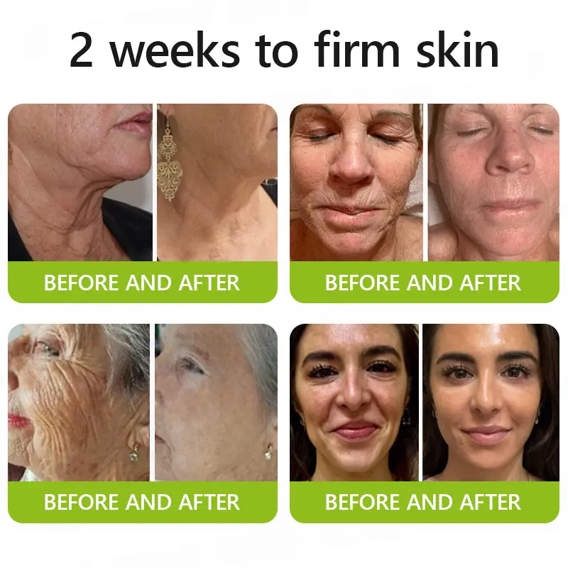 Peptide-Infused Firming Shot , Dermatologist-Approved Formula for Powerful Lifting Visibly De-puffing - Image 3
