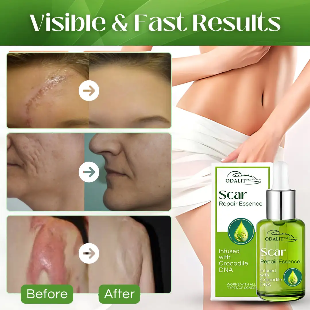 Scar Repair Essence - Image 3