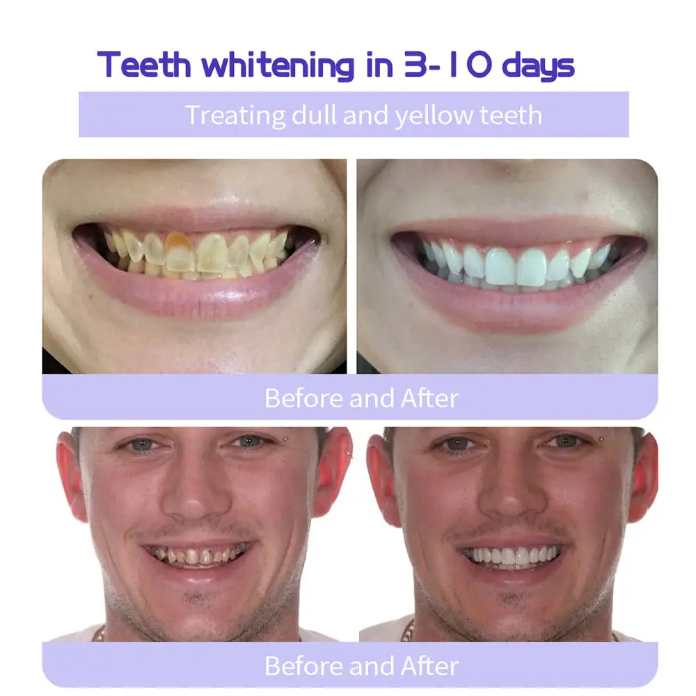 TeethRestoration Mineral Powder - Image 11