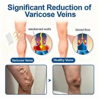 VeinEase Care Patch - Image 4