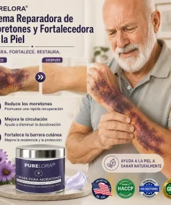 cream to repair bruises and strengthen the skin