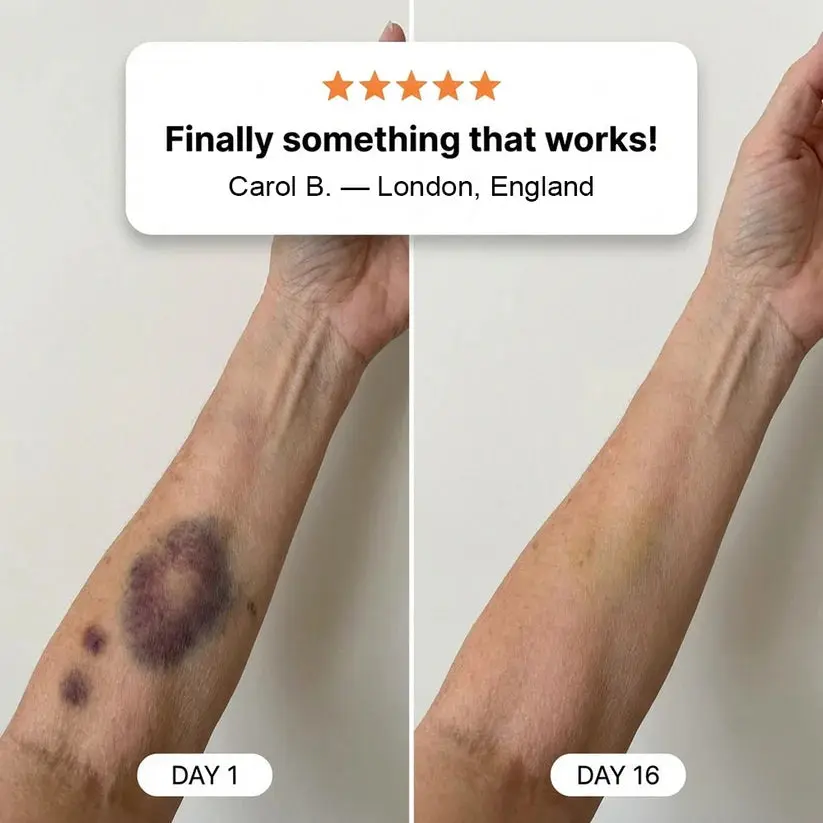 cream to repair bruises and strengthen the skin - Image 2