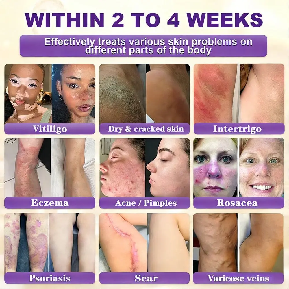 Biotin 10-in-1 Skin Repair Cream - Image 2