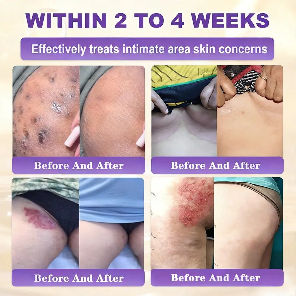 Biotin 10-in-1 Skin Repair Cream - Image 4