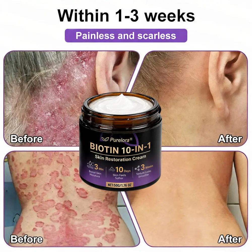 Biotin 10-in-1 Skin Repair Cream - Image 5
