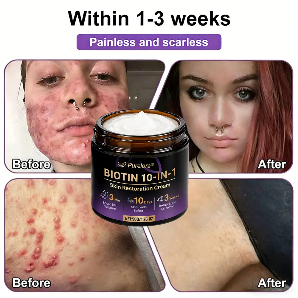 Biotin 10-in-1 Skin Repair Cream - Image 6