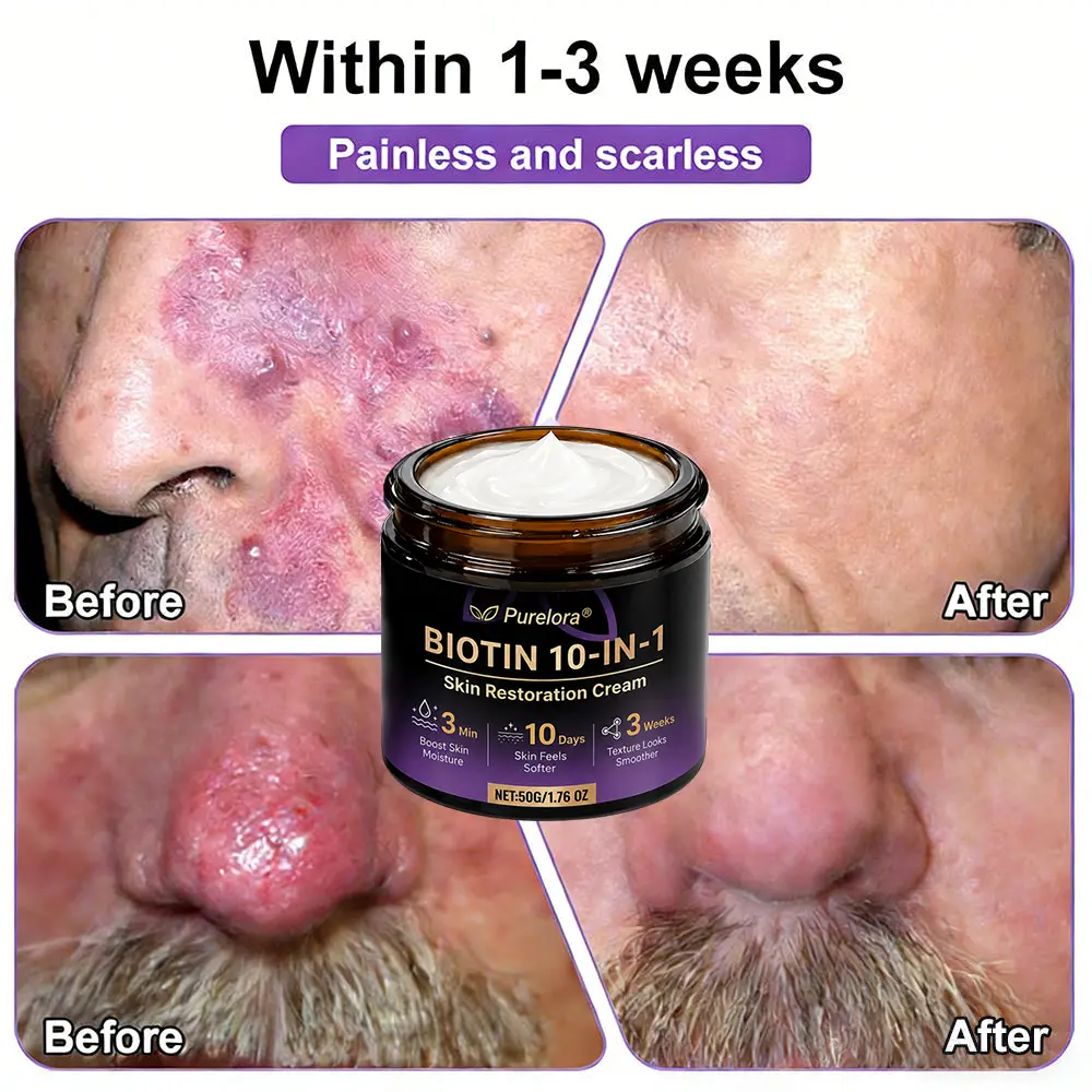 Biotin 10-in-1 Skin Repair Cream - Image 8
