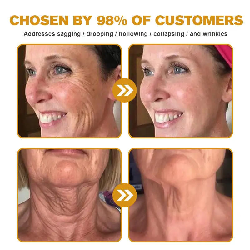 Botox Bee Venom Wrinkle Removal Cream - Image 3