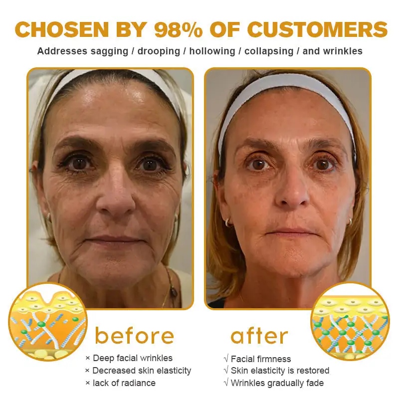 Botox Bee Venom Wrinkle Removal Cream - Image 4