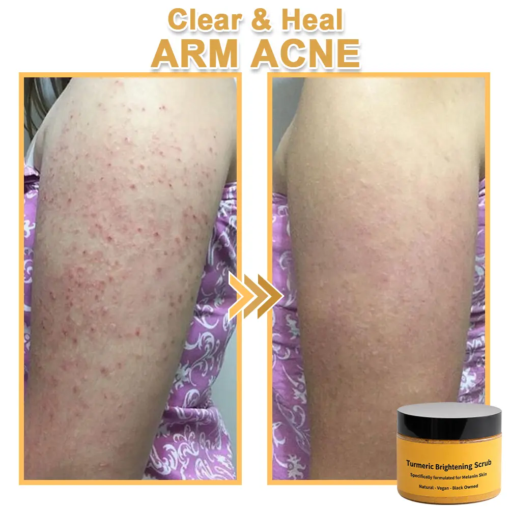 Turmeric Exfoliating Body - Image 10