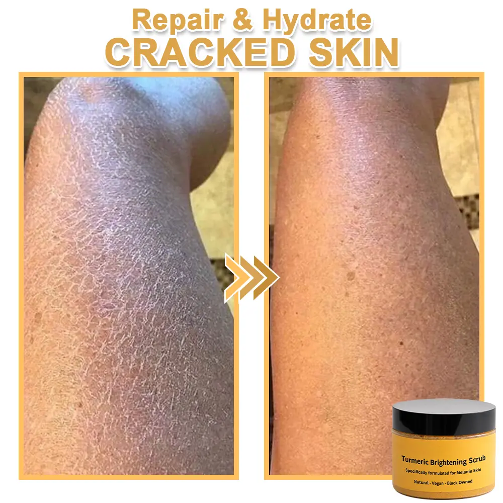 Turmeric Exfoliating Body - Image 12