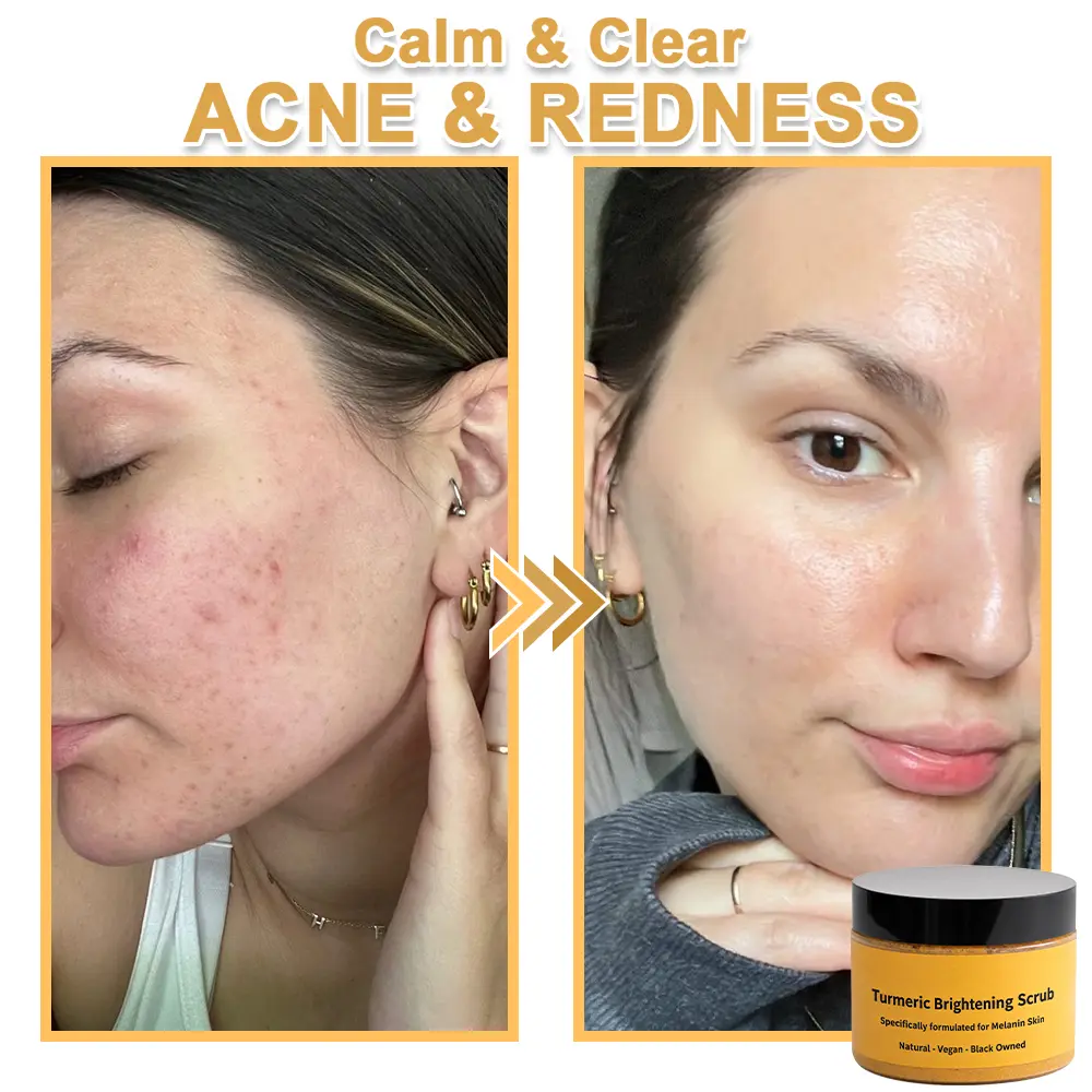 Turmeric Exfoliating Body - Image 13