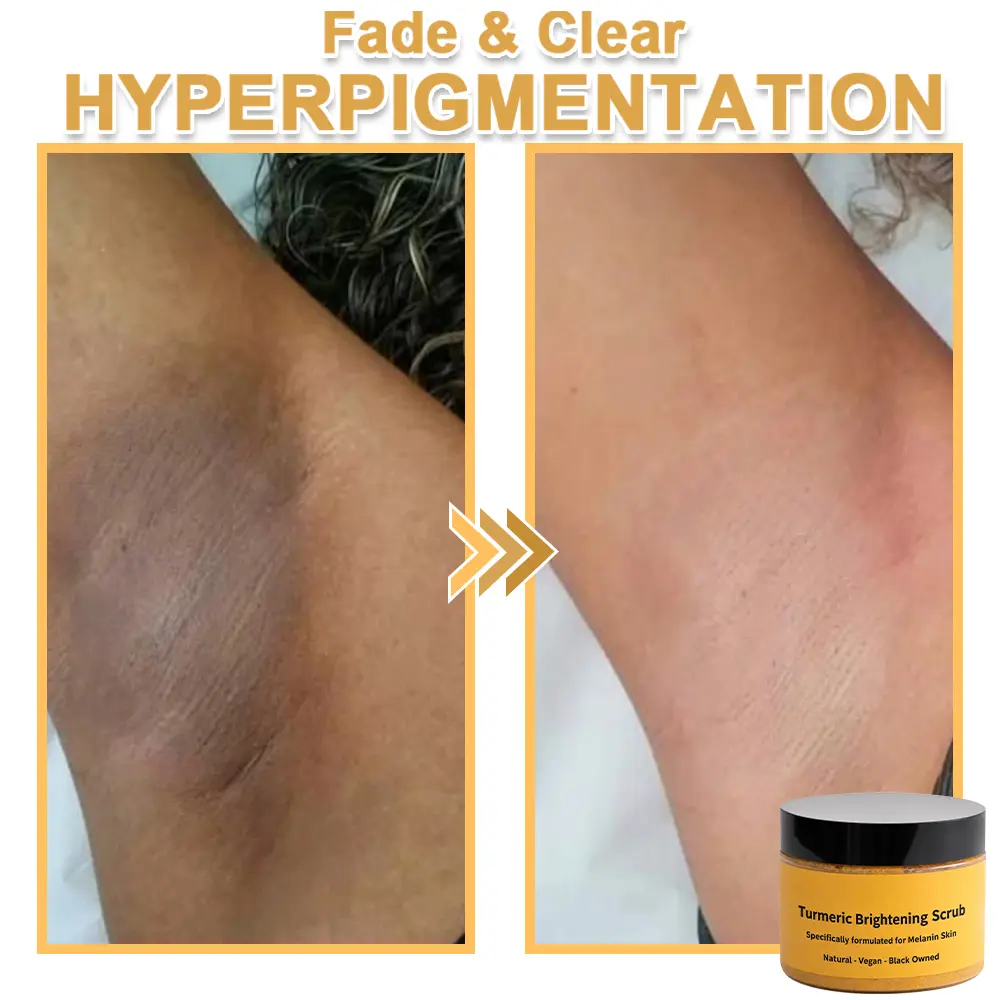 Turmeric Exfoliating Body - Image 14