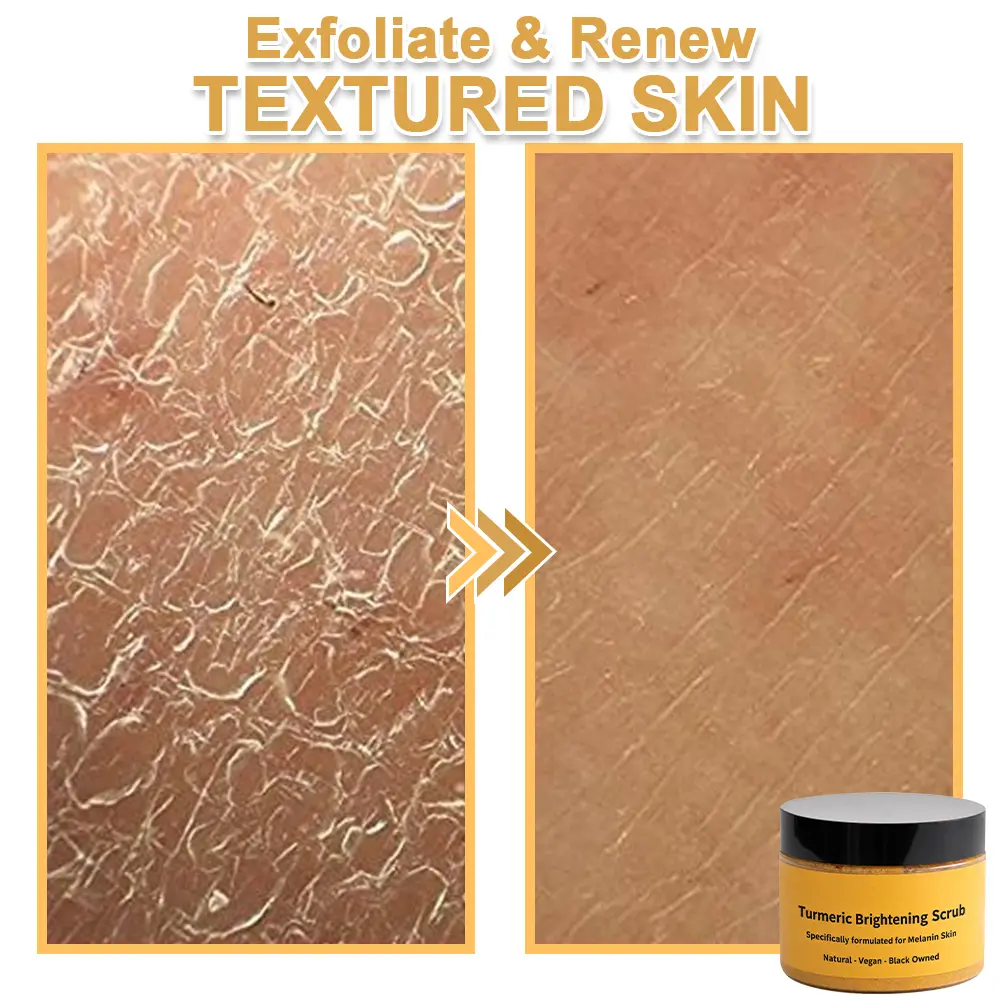 Turmeric Exfoliating Body - Image 15