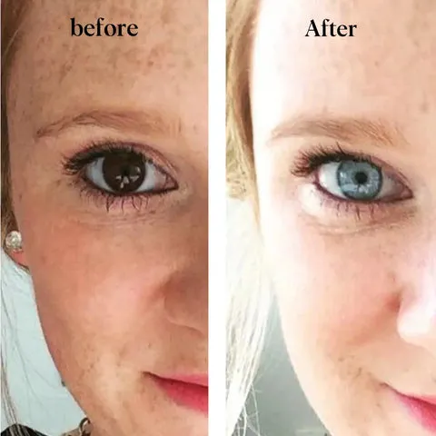 Enhancement & Changing Eye Color Eye Drops - Image 4
