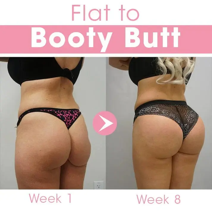 BREAST HIP ENHANCEMENT CREAM - Image 7