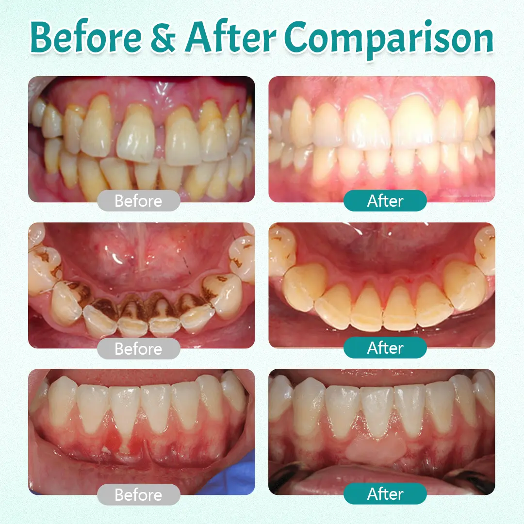 HerbTakt Oral Repair Solution - Image 4
